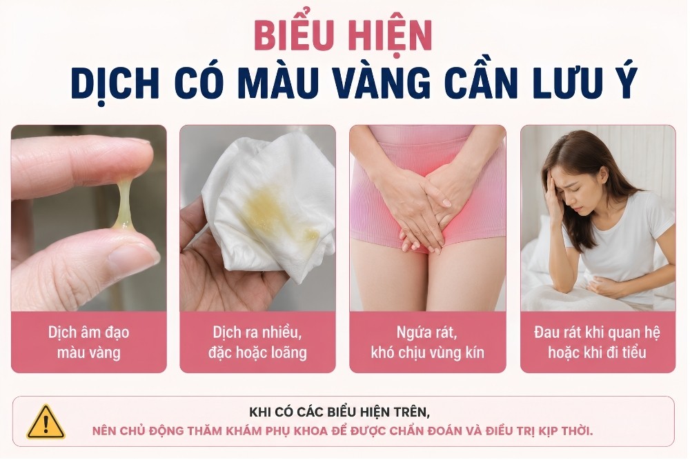 Dịch Có Màu Vàng Là Dấu Hiệu Của Bệnh Gì?