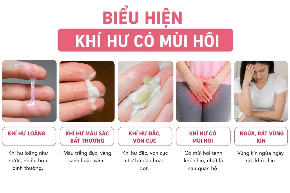 Khí Hư Có Mùi Hôi Là Bị Gì? Cảnh Báo Những Bệnh Phụ Khoa Thường Gặp