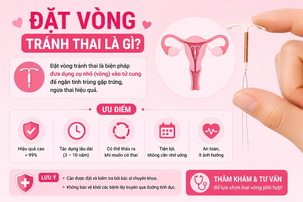 Đặt Vòng Tránh Thai An Toàn Tại [tenpk]: Giải Pháp Kế Hoạch Hóa Gia Đình Hiệu Quả