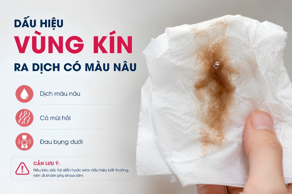 Đừng Chủ Quan Khi Dịch Có Màu Nâu Bất Thường