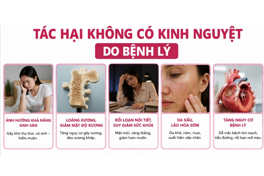 Không Có Kinh Trong Thời Gian Dài: Dấu Hiệu Bất Thường Chị Em Không Nên Bỏ Qua