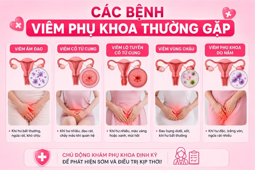 Điều Trị Viêm Phụ Khoa Sớm – Giải Pháp Bảo Vệ Sức Khỏe Sinh Sản